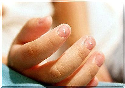 5 signs of poor health visible on the nails: nails with streaks